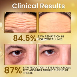 24K Gold Serum, 99.9% Pure Gold Anti Aging serum with retinol 1% Hyaluronic Acid Niacinamide,Vitamin C&E deep Hydration and Firming Skin Care Glow Radiiance booster Serum 30ML/1.01 Oz