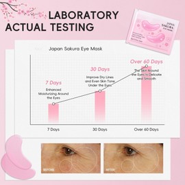 12Pairs Sakura Eye Patches for Dark Circles - Eye Masks for Puffy Eyes - Eye Mask for Fine Lines & Eye Bags - l Under Eye Gel Patche for Women & Men - Hydratin & Firming & Vegan Cruelty-Free