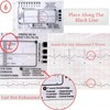 2pcs ECG 7 Step Ruler, Portable Assessment Tool for ECG/EKG