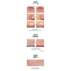 Paul Madison Aloe Carederm Thin Spot Patch 68 pieces, 68 sheets, 5 pieces / 폴메디슨 알로에 케어덤씬 스팟패치 68개입 68매, 5개