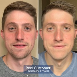 Strive - Anti-aging Retinal Serum - 0.1% Retinaldehyde, 10% Peptides & 2% Vitamin C E Ferulic Face Serum. Brightening, Firming, Wrinkle & Fine Line Reducing - Fragrance Free Anti aging Skincare - 30mL