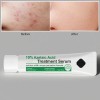 Srum Facial Azelaic 12 45 G Para El Cuidado De