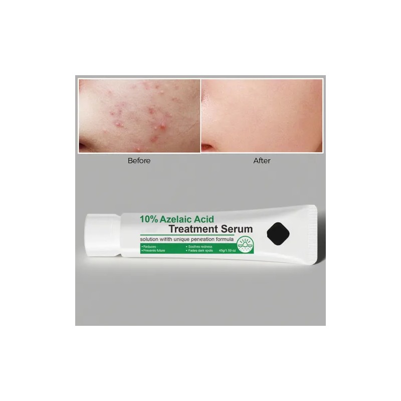 Srum Facial Azelaic 12 45 G Para El Cuidado De