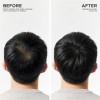 . Acondicionador Espesante Para La Caída Del Cabello Dr. .