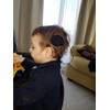 Ear Gear Rondo M1 Mono – Protect Implants from Dirt,