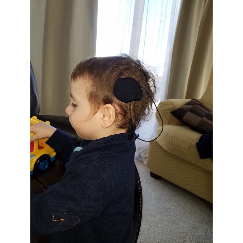 Ear Gear Rondo M1 Mono – Protect Implants from Dirt,