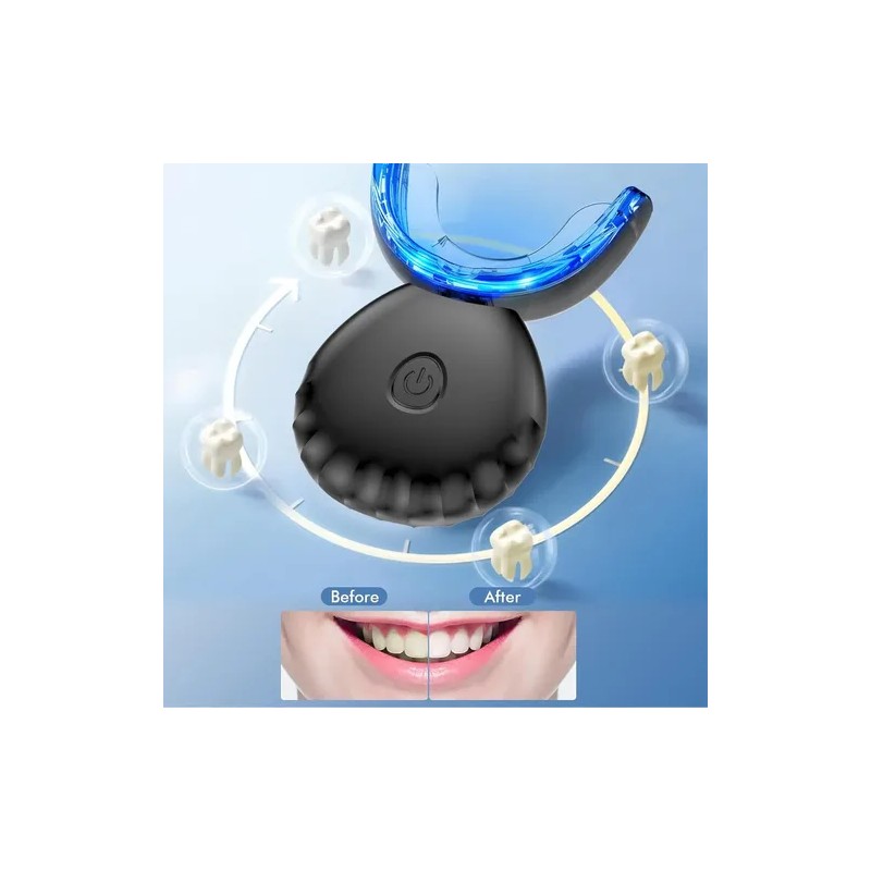 Luz De Blanqueamiento De Dientes, Luz Led Azul 10 Veces