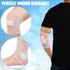 Tubular Bandage Elastic Net Wound Dressing Elastic Dressing Retainer Tubular