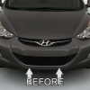 Automotive Authority CHROME GRILLE GRILL TRIM For HYUNDAI ELANTRA 2011-2016