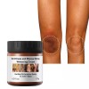 New Strong Whitening Cream For Removing Dark Knuckle Finger Elbow