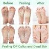 Paquete de 5 mascarillas exfoliantes de pies, exfoliante pelar callosidades