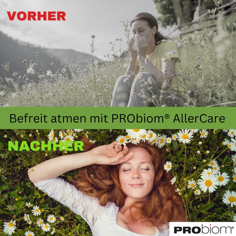 PRObiom AllerCare for Overreacting Immune System - Clinically Tested Bacterial