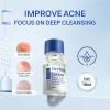 Sérum Facial Ácido Salicílico Tratamiento Acné Puntos Negros