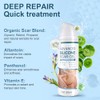 Mitgary Crema Avanzada Para Cicatrices, Gel De Silicona Para Cicatrices,