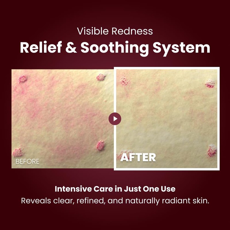 KOPHER Curepair Melder SOS Cream [4ever Edition] –Peptide Repair Night