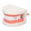 Dental Disease Caries Teeth Model Resin Simulation Teaching Prop Dental