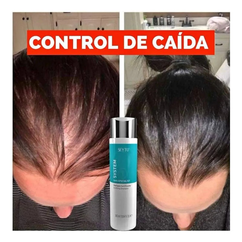 Shampoo Fortificante Para Caida Y Crecimiento De Cabello