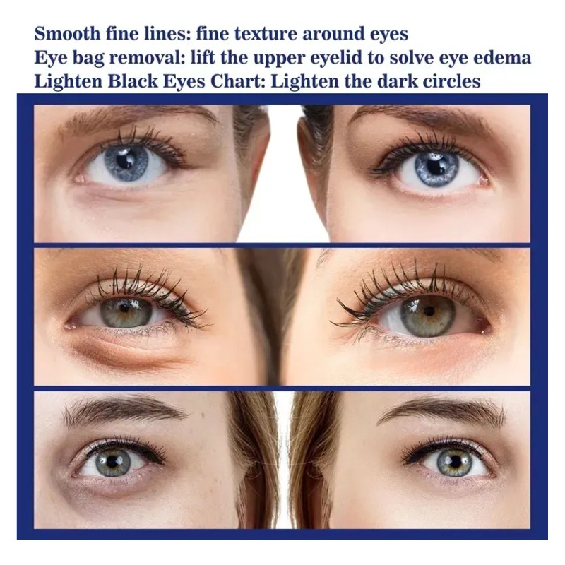 Ae Crema Hidratante Activa For El Contorno De Ojos