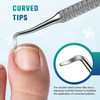 FERYES 50 PCS Breathable Ingrown Toenail Corrector Patch with Double-Ended