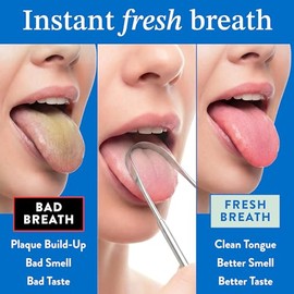 Mouthology Raspador De Lengua Para Adultos, Raspador De Lengua De Metal De Acero Inoxidable Para Limpiar La Lengua Y Reducir El Mal Aliento, Raspador 