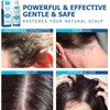 Roycederm Champú para la psoriasis, dermatitis seborreica, foliculitis y caspa,
