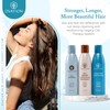 Ovation Legacy Cell Therapy 6 oz. System