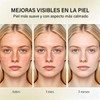 Crema con Ácido Azelaico al 10%, 50g