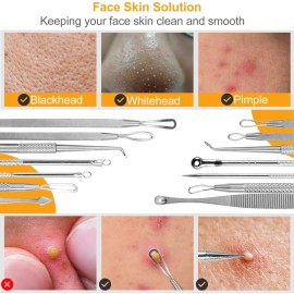 7-Piece Silver Blackhead Acne Extractor Kit Stainless Steel Pimple & Needle Tools Blackhead RemoverColor: Silver Color