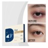 Parches De Protección Ocular Hidratantes Y Calmantes Zh Xq