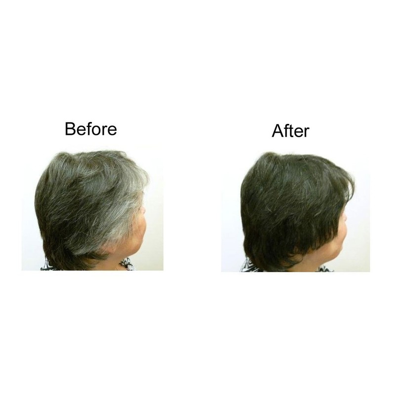 My Secret Correctives Hair Enhancer for Fine/Thinning Hair - 5