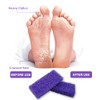 BPrettier Foot Pumice Stone Pumice Stone for Feet Foot Scrubber