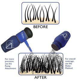 Infinity Hair Building Fibers To Conceal Thinning For The Appearance Of Thicker, Fuller Women & Men - Auburn 28G