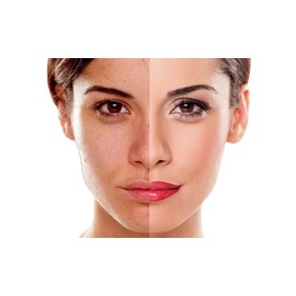 3 Pack Jabón de Leche de Arroz tailandes, Jabón Blanqueador Hidratante con Colágeno y Vitamina E, Blanquea e Hidrata la Piel, Jabón Aclarante Exfoliante, Humectante Limpiador Facial