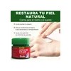 Crema Para Eczema Alivio De La Picazón E Irritación 25g