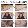 Crema Depilatoria Cuerpo De Vello Sin Dolor Para Hombres, Cr