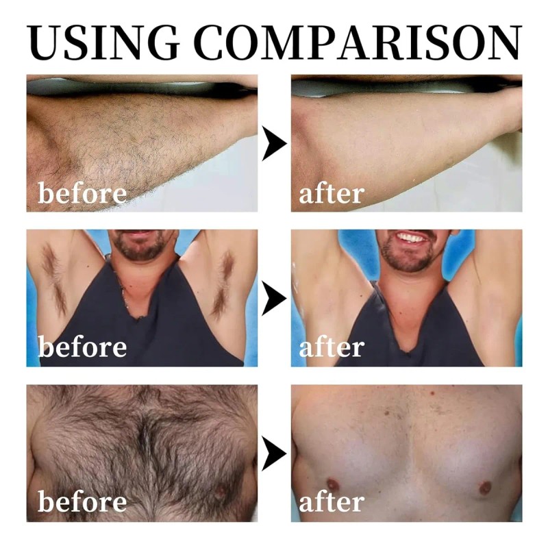 Crema Depilatoria Cuerpo De Vello Sin Dolor Para Hombres, Cr