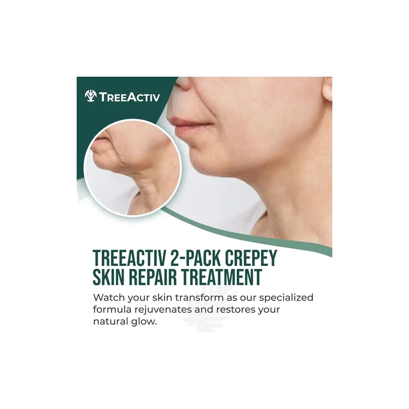 Treeactiv Crepey Skin Repair Treatment, Paquete De 2, Crema