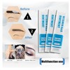 Gakonp 50pcs Tattoo Aftercare Ointment Vitamin A&D Moisturizing Gel