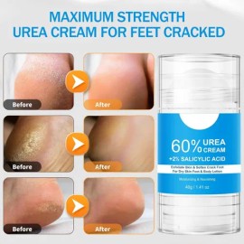 Crema De Urea De Máxima Potencia Para Pies, 2 Unidades
