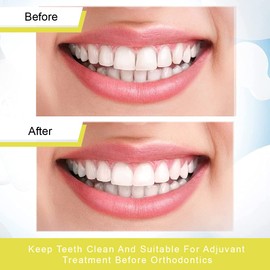 CUHZA Tooth Sandpaper, Dental Polishing Strips, Ultra Fine Size, 20μm Size of Grains - 4 mm Width, Resin Tooth Polishing Interdental Sanding Tool