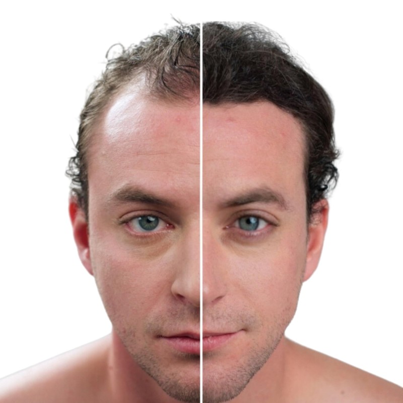 Capelli Fibras Capilares para Pérdida de Cabello, Polvo de Disimulación