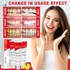 Pack of 3 Sp-6 Toothpaste Probiotic Toothpaste, Sp 6 Probiotic