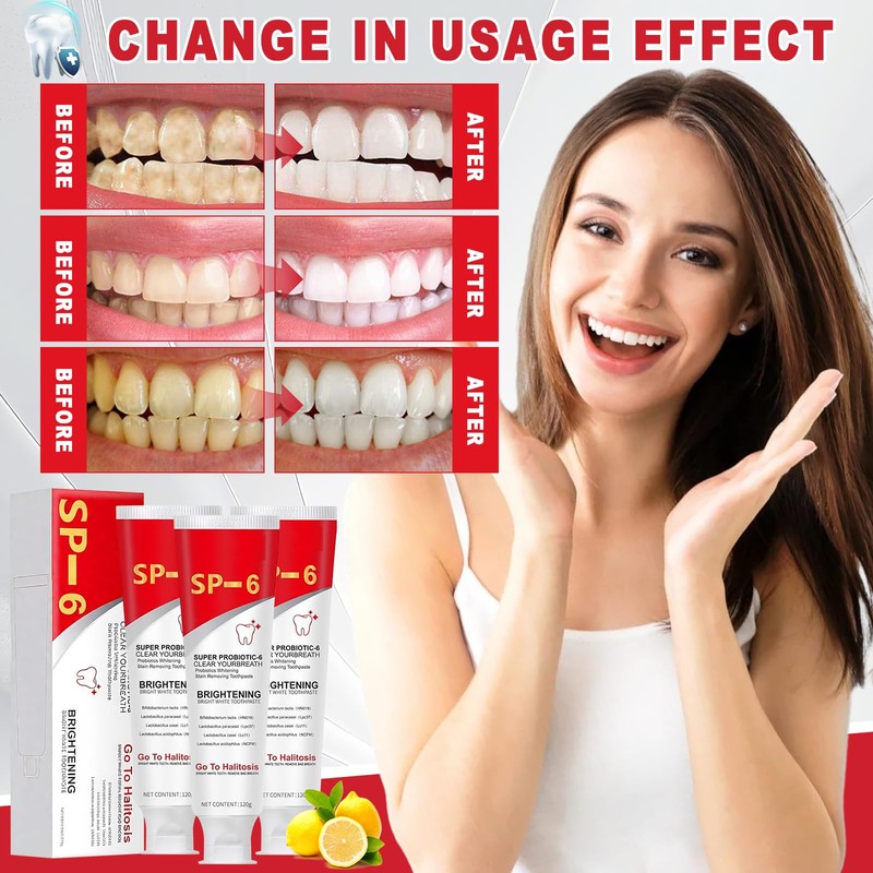 Pack of 3 Sp-6 Toothpaste Probiotic Toothpaste, Sp 6 Probiotic