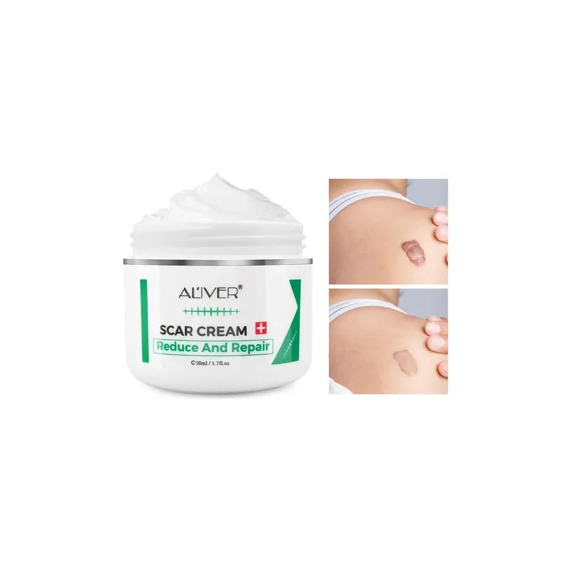 Crema Repara Cicatrices Antiedad Quemaduras Estrías