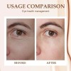 3u Hidratante Para Los Ojo Contra Las Ojeras Y Las
