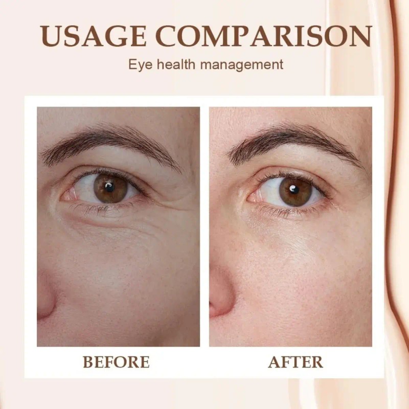 3u Hidratante Para Los Ojo Contra Las Ojeras Y Las