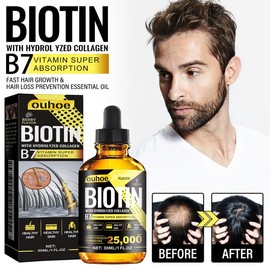 OUHOE Collagen B7 & Biotin Hair Growth Oil - Nourishing Essence for Soft, Strong Hair | Repairing Hair Mask & Scalp Treatment | Heat Protectant & Frizz Control | Vitamin Enriched for Damaged Hair Care - Colour: 2