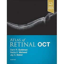 Atlas of Retinal OCT: Optical Coherence Tomography