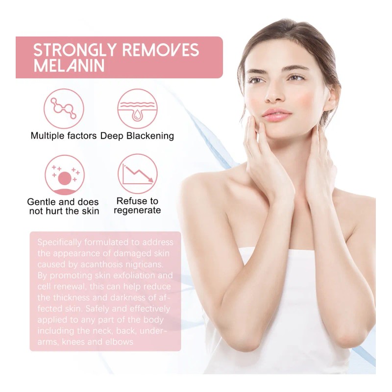 Repara La Precipitación Negra En Codos Y Pies, Crema De