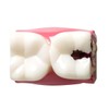 Sarini Tooth Model, Caries Comparative Study Model,Dentist Dental Anatomy Educational